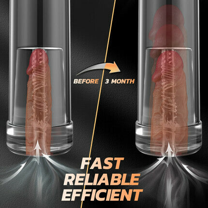 ACMEJOY - Vakuum-Saug-Penispumpe